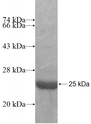 Recombinant Human SSX3 SDS-PAGE