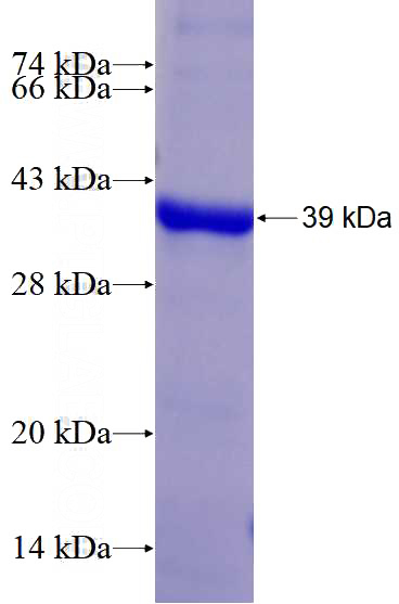 Recombinant Human BUB1 SDS-PAGE
