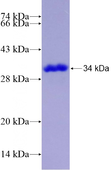Recombinant Human GGH SDS-PAGE