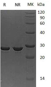 Human APOA1 (His tag) recombinant protein