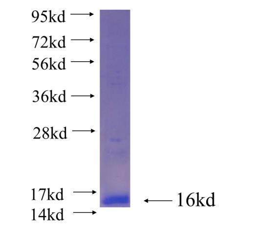 Recombinant human GALR2 SDS-PAGE