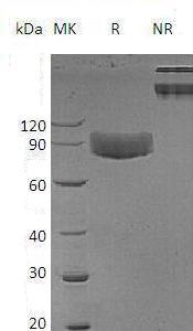 Human IL1R1/IL1R/IL1RA/IL1RT1 (Fc tag) recombinant protein