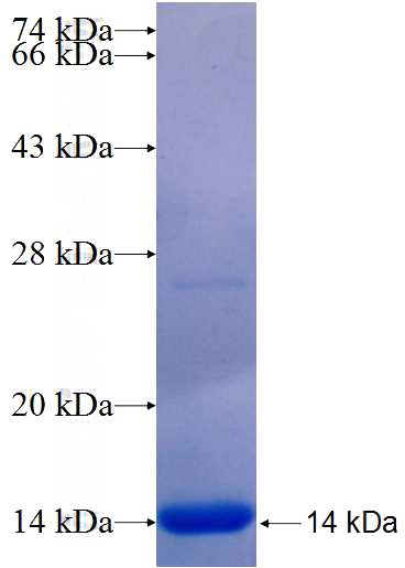 Recombinant Human CD109 SDS-PAGE