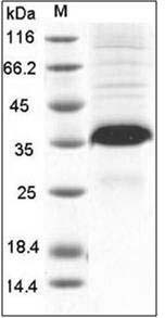Mouse FLRG / Fstl3 Protein (His Tag) SDS-PAGE