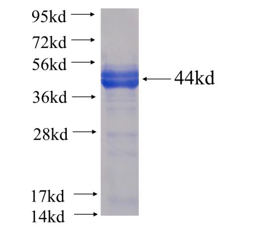 Recombinant human RIC8B SDS-PAGE