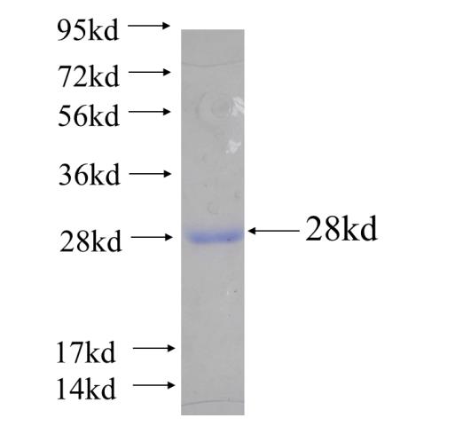 Recombinant human HERPUD2 SDS-PAGE