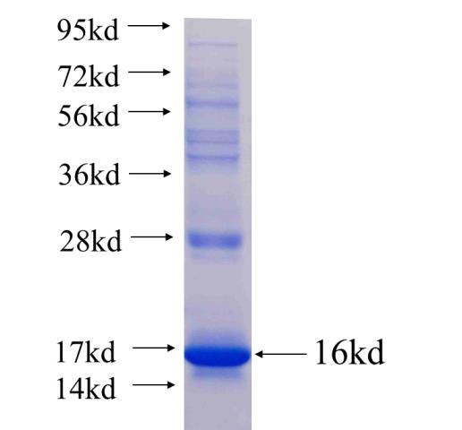 Recombinant human LILRA4 SDS-PAGE