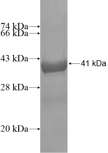 Recombinant Human RPL22L1 SDS-PAGE