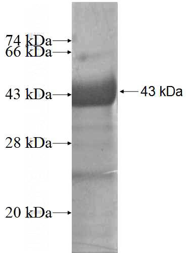 Recombinant Human CLCA2 SDS-PAGE