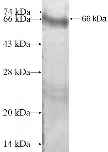 Recombinant Human ETV1 SDS-PAGE