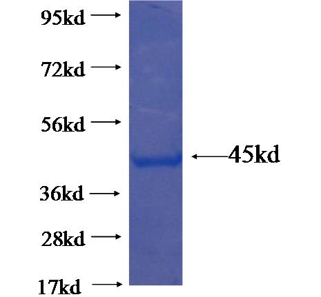 Recombinant human FDXACB1 SDS-PAGE
