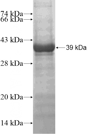 Recombinant Human ADARB2 SDS-PAGE