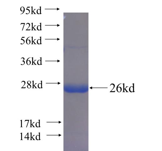 Recombinant human EGR3 SDS-PAGE