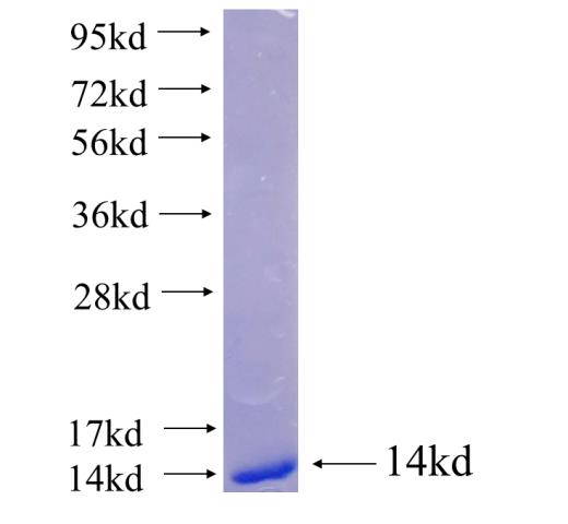 Recombinant human CTGF SDS-PAGE