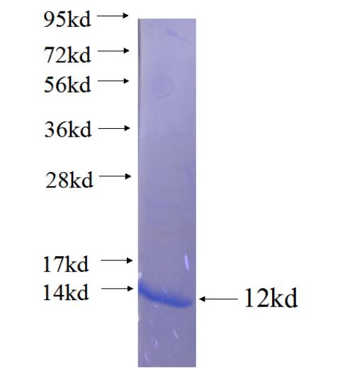 Recombinant human SLC4A5 SDS-PAGE