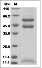 Rhesus TGF-beta 2 / TGFB2 Protein (His Tag)