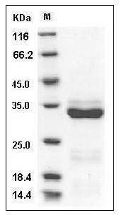 Human Trypsin-3 / PRSS3 Protein (His Tag) SDS-PAGE