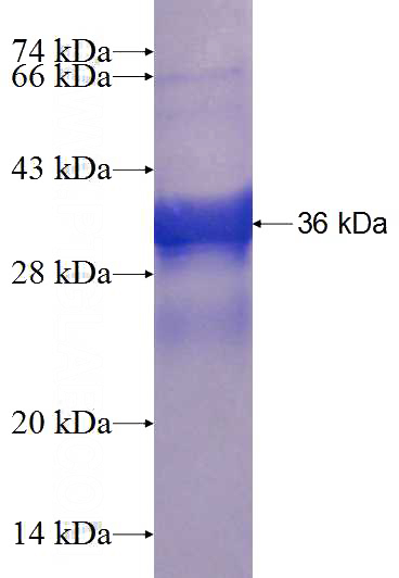 Recombinant Human L3MBTL4 SDS-PAGE