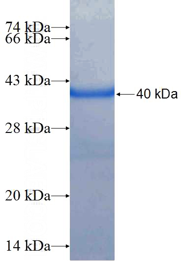 Recombinant Human ZFPL1 SDS-PAGE