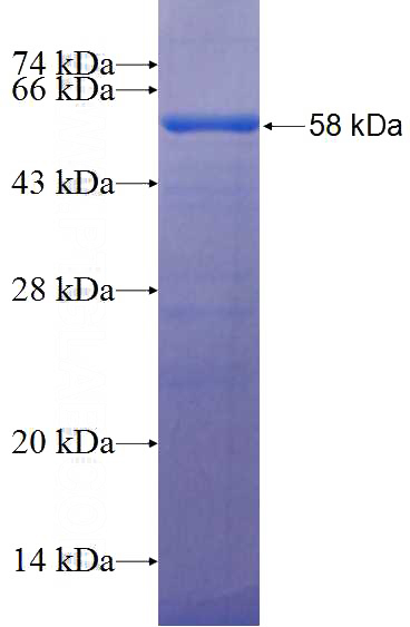 Recombinant Human SYNPO2 SDS-PAGE