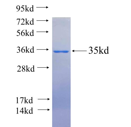 Recombinant human SGCA SDS-PAGE