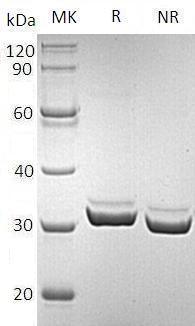 Human MYOC/GLC1A/TIGR (His tag) recombinant protein