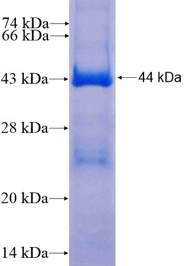 Recombinant Human MUT SDS-PAGE