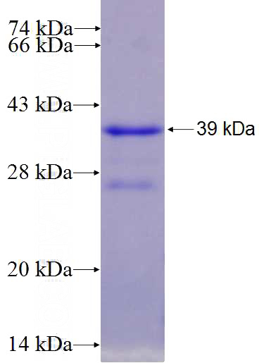 Recombinant Human GNB3 SDS-PAGE