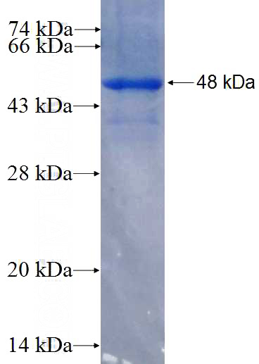 Recombinant Human ZNF623 SDS-PAGE