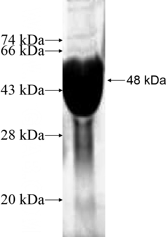 Recombinant Human FREQ SDS-PAGE