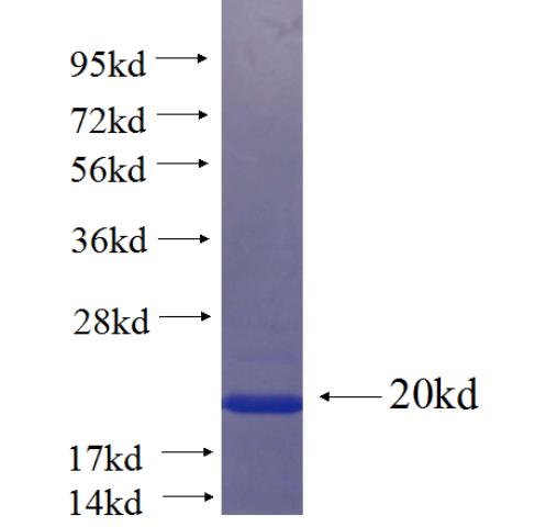 Recombinant human SLCO5A1 SDS-PAGE