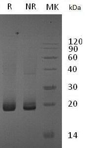 Mouse Esm1 (His tag) recombinant protein