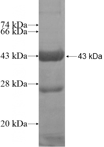 Recombinant Human UCHL5IP SDS-PAGE