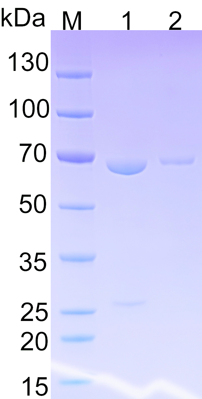 Recombinant human LONP2 SDS-PAGE