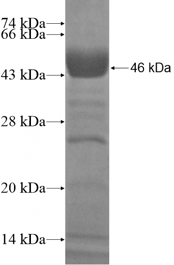 Recombinant Human WDTC1 SDS-PAGE