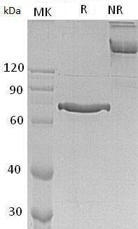 Human CYR61/CCN1/GIG1/IGFBP10 (Fc tag) recombinant protein