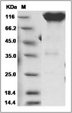 Rat PDGFRa / CD140a Protein (Fc Tag) SDS-PAGE