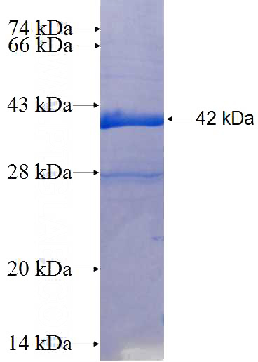 Recombinant Human TAF5 SDS-PAGE