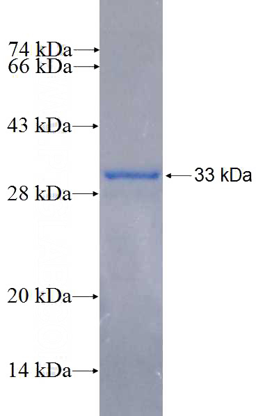 Recombinant Human CNTNAP3 SDS-PAGE