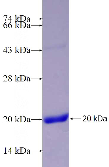 Recombinant Human WNT5B SDS-PAGE