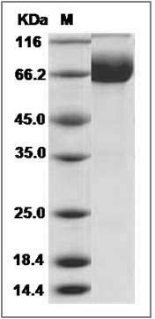 Canine IL1R2 / IL1RB Protein (Fc Tag) SDS-PAGE