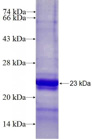 Recombinant Human NAP1L4 SDS-PAGE