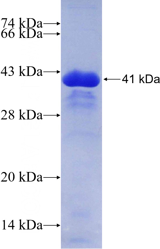 Recombinant Human ARPP-19 SDS-PAGE