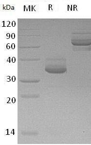 Human CXCL10/INP10/SCYB10 (Fc & His tag) recombinant protein