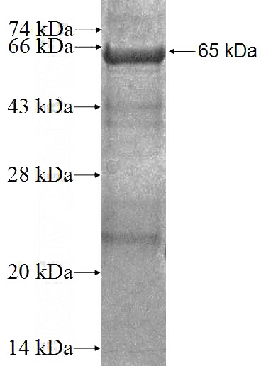 Recombinant Human RTDR1 SDS-PAGE