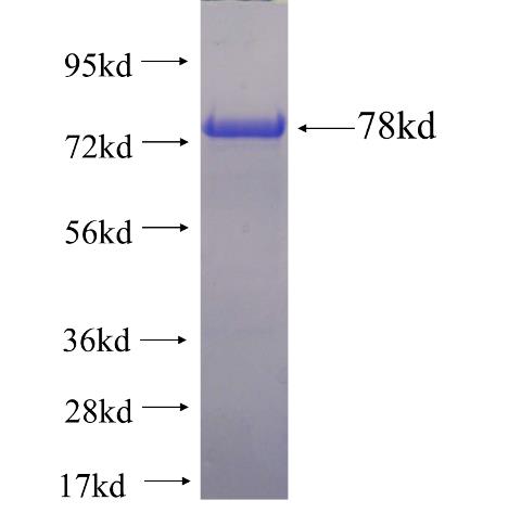 Recombinant human COPS2 SDS-PAGE