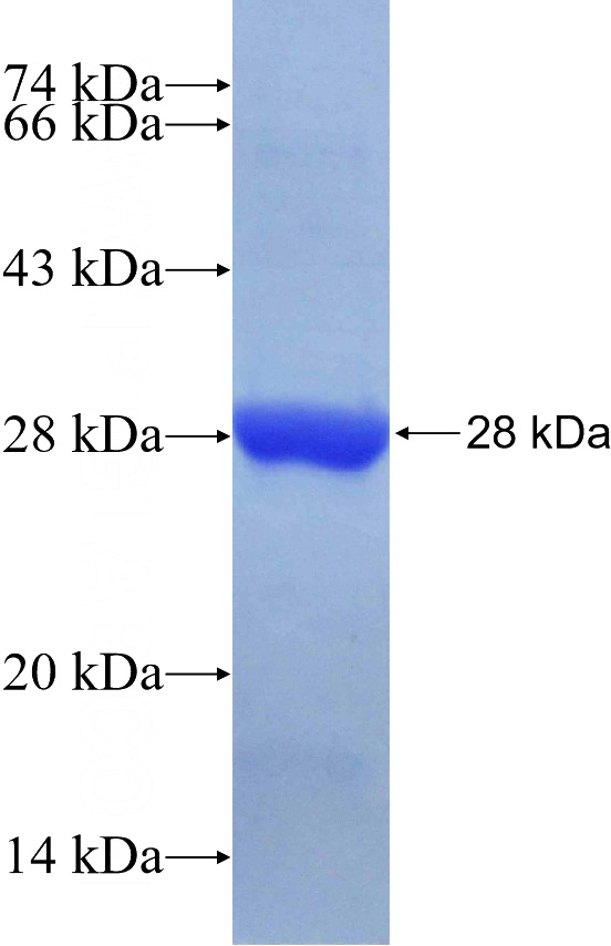 Recombinant Human Rad51D SDS-PAGE