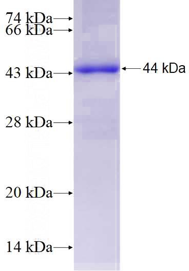 Recombinant Human MCM5 SDS-PAGE