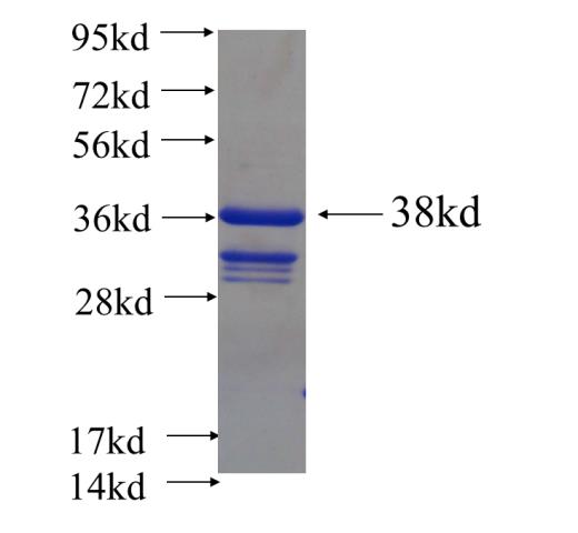 Recombinant human ZNF460 SDS-PAGE