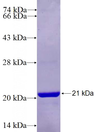 Recombinant Human C15orf24 SDS-PAGE